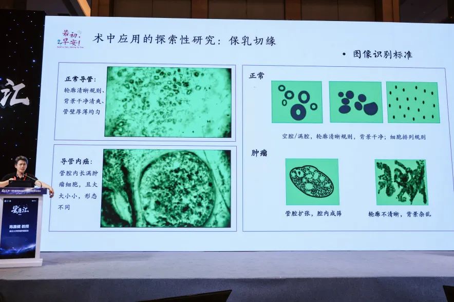 細胞級熒光導引技術亮相沈陽乳腺癌論壇，EndoSCell?破解術中切緣判讀難題(圖6)